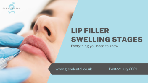 Lip Filler Swelling Stages - Everything You Need To Know